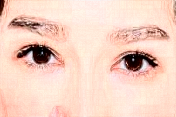 武汉涵美开眼角行不行