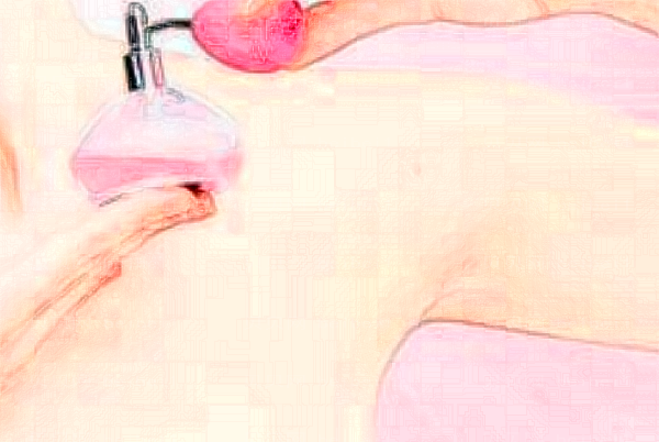 永州美辰去腋臭可靠吗
