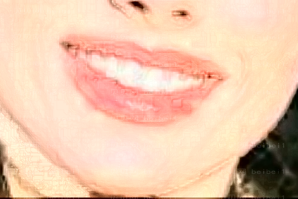 南昌艾莱芙烟渍牙美白如何
