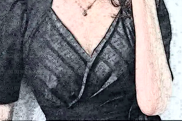 乌鲁木齐花之妍抽脂缩小巨乳口碑好不好