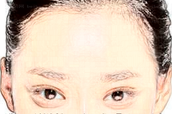 温州名人彩光嫩肤选哪个医生
