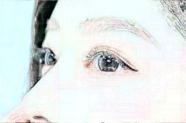 南阳华美做卧蚕失败修复哪个医生水平比较好