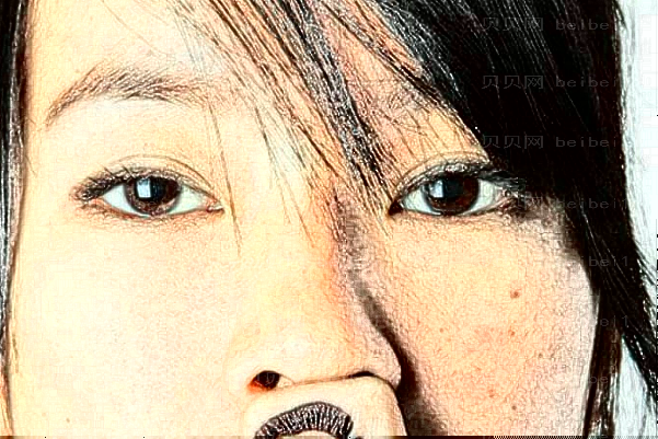 佛山美莱E光去鱼尾纹医生介绍