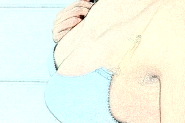 桂林星范乳房再造哪个医生做得好