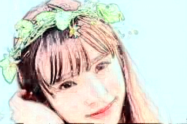 青岛华韩玻尿酸去抬头纹如何