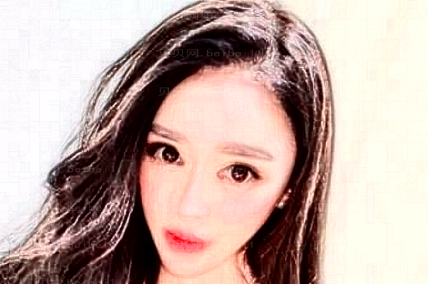 常州曙光去晒斑做的如何