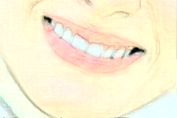 宁夏华美牙齿矫正哪个医生做的好