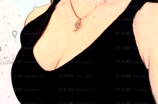 广西格林美菲硅胶乳房再造好不好