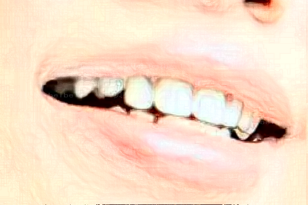 合肥韩美牙齿缺损修复做得好的医生