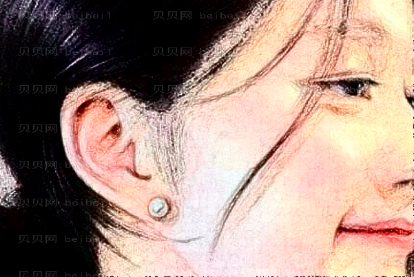曲靖美莱耳部矫正修复可信吗