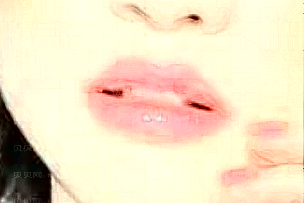 漯河缔美俪丰唇珠推荐医生