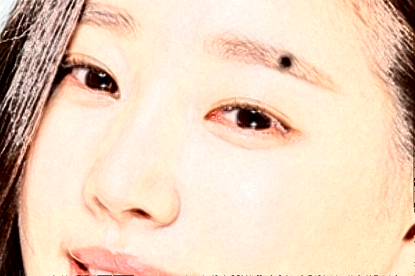 唐山苏亚美联臣聚左旋乳酸去法令纹口碑如何