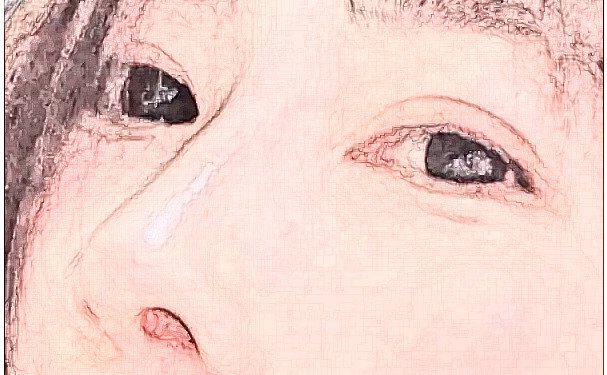 西安做上睑下垂那个医院好|画美、叶子等有着颇高的技术
