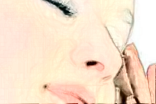 海南韩美鼻孔缩小怎么样