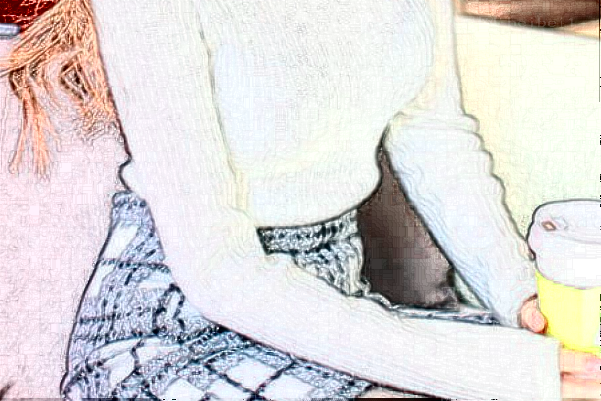 郑州美莱射频去妊娠纹怎么样