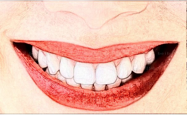 深圳美莱牙齿清洁详细内容