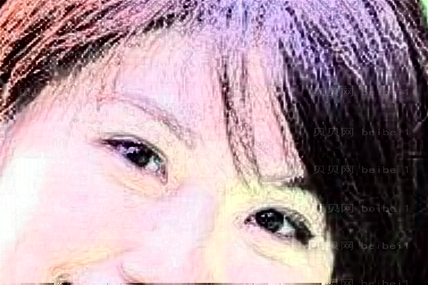 丹东晶馨E光去法令纹医生实力怎么样