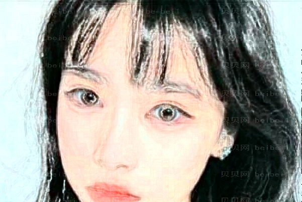 益阳格莱美超声法去眼袋正规吗