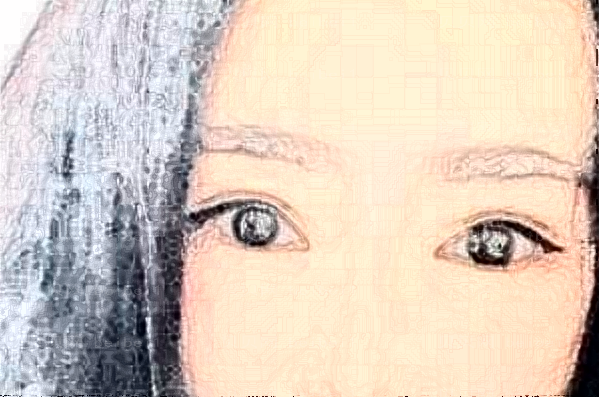 长沙艾缇射频去鱼尾纹做的怎么样