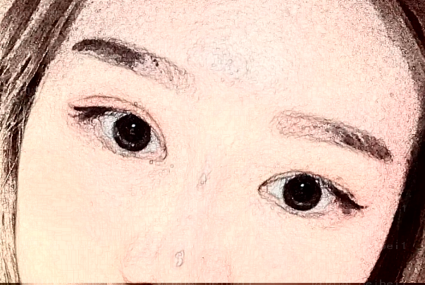 呼和浩特华医去黑眼圈失败修复做的怎么样