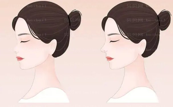 哈尔滨隆鼻失败修复比较好的医院