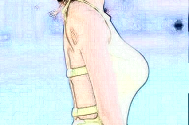 台州薇阁双环法矫正乳房下垂医生推荐