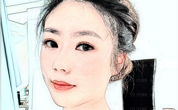 成都八大处马继光拉皮失败修复好不好?多少钱?案例及技术评价公开