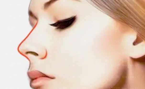 长沙星美域付博做鼻子怎么样?可靠吗?技术简介