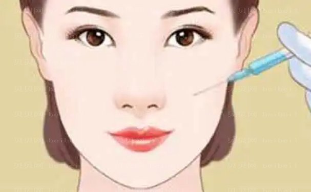 成都润美玉之光柳军玻尿酸填充多少钱?医生口碑介绍