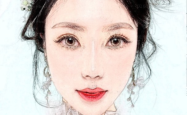 哈尔滨臻美王丹丹初鼻做的好吗？医生案例+技术点评